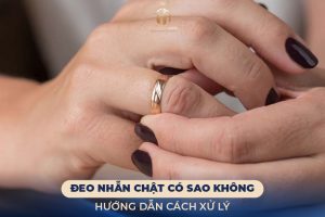 Đeo Nhẫn Chật Có Sao Không? Hướng Dẫn Cách Xử Lý Nhanh Nhất